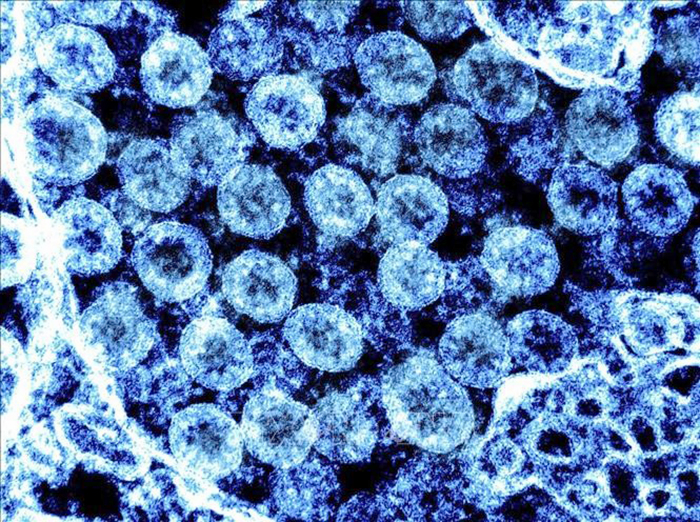 Israel phát hiện biến thể EG.5.1 của virus SARS-CoV-2